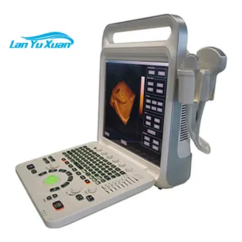 Široko Používaný XF3600V Plný Digitálny Farebný Doppler Systém Tehotenstva Skener Ecomed Ručné Ručné Ultrazvuk