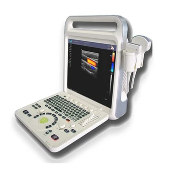 Veľkoobchod E60 Plný Digitálny Farebný Doppler Systém Dodávateľov Terapeutické Prenosný Ultrazvuk Zariadenia