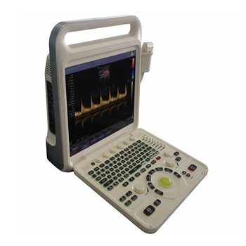 Veľkoobchod E60 Plný Digitálny Farebný Doppler Systém Dodávateľov Terapeutické Prenosný Ultrazvuk Zariadenia Veľkoobchod E60 Plný Digitálny Farebný Doppler Systém Dodávateľov Terapeutické Prenosný Ultrazvuk Zariadenia 1