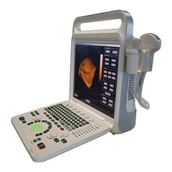 Veľkoobchod E60 Plný Digitálny Farebný Doppler Systém Dodávateľov Terapeutické Prenosný Ultrazvuk Zariadenia Veľkoobchod E60 Plný Digitálny Farebný Doppler Systém Dodávateľov Terapeutické Prenosný Ultrazvuk Zariadenia 2