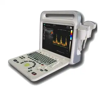 Veľkoobchod E60 Plný Digitálny Farebný Doppler Systém Dodávateľov Terapeutické Prenosný Ultrazvuk Zariadenia Veľkoobchod E60 Plný Digitálny Farebný Doppler Systém Dodávateľov Terapeutické Prenosný Ultrazvuk Zariadenia 5